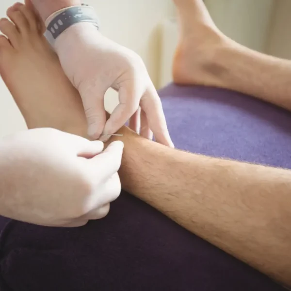 Diabetic Foot Care at Curific Health Care