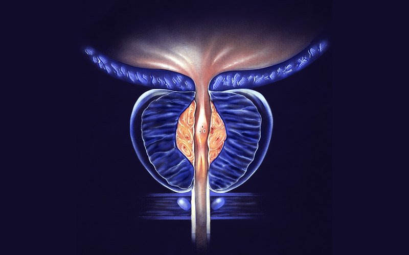 Enlarged Prostate Treatment Treatment at Curific Health Care